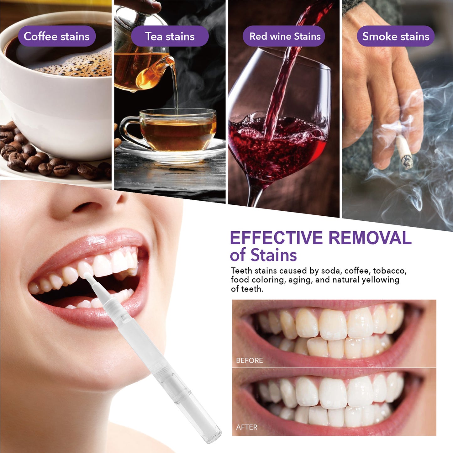 35% Carbamide Peroxide Teeth Whitening Gel Pen -2ml