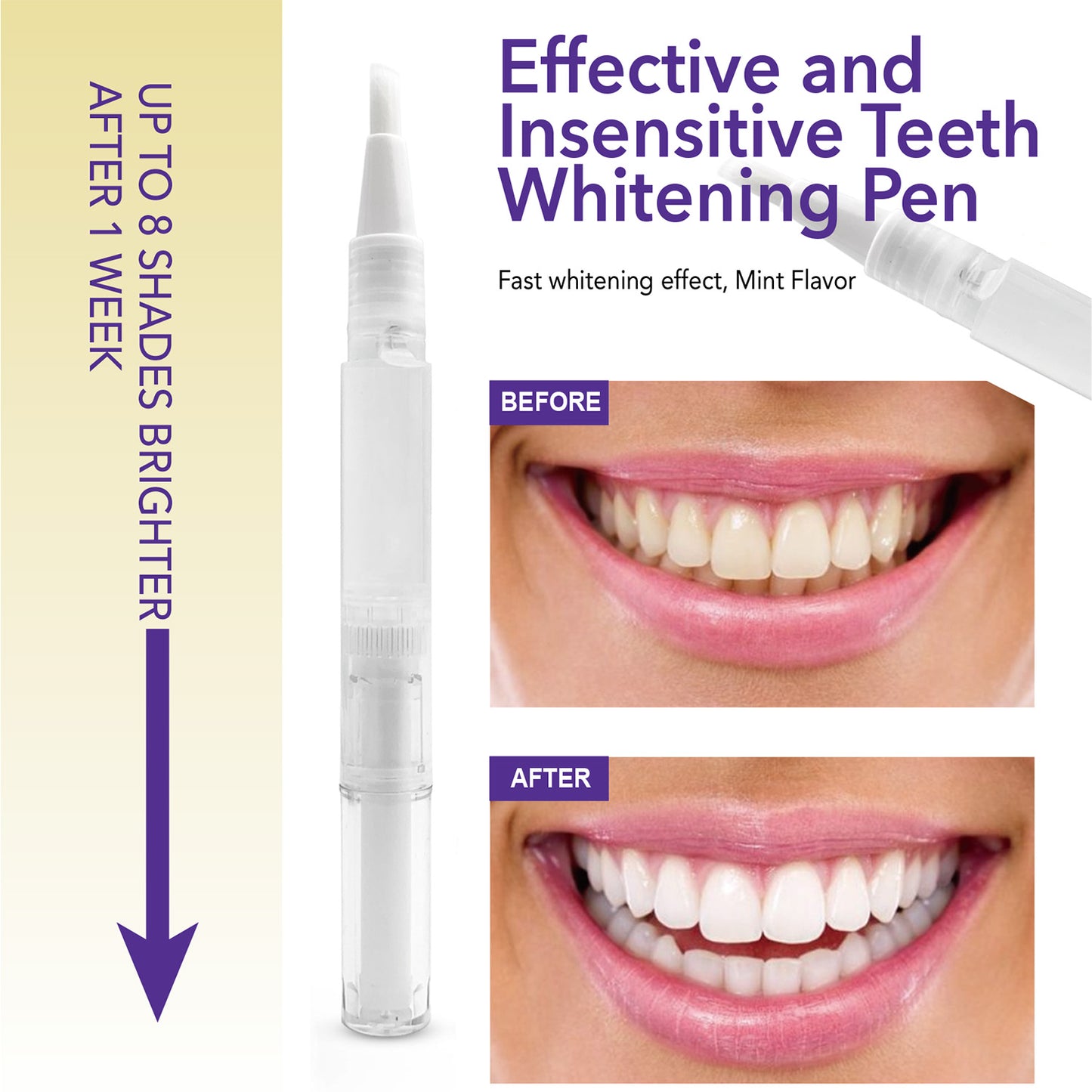 35% Carbamide Peroxide Teeth Whitening Gel Pen -2ml